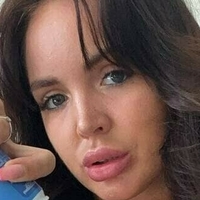 ccherrylipsx Nude