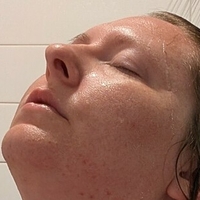 titlaser Nude